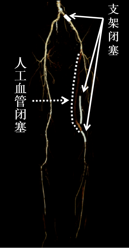 c1d5cab6c2a3e9ecb98bec86ed6f0720.png